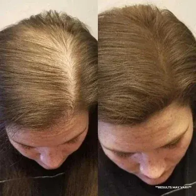 Jennifer M. before and after