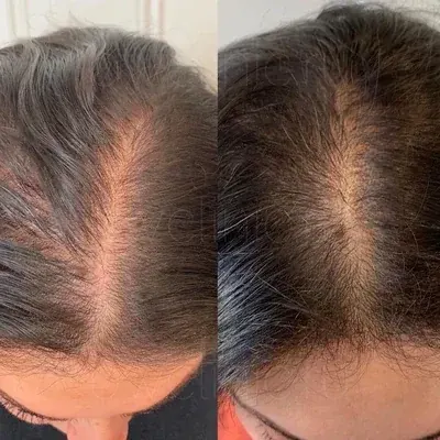 Karen T. before and after