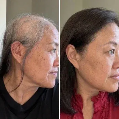 Lisa K. before and after
