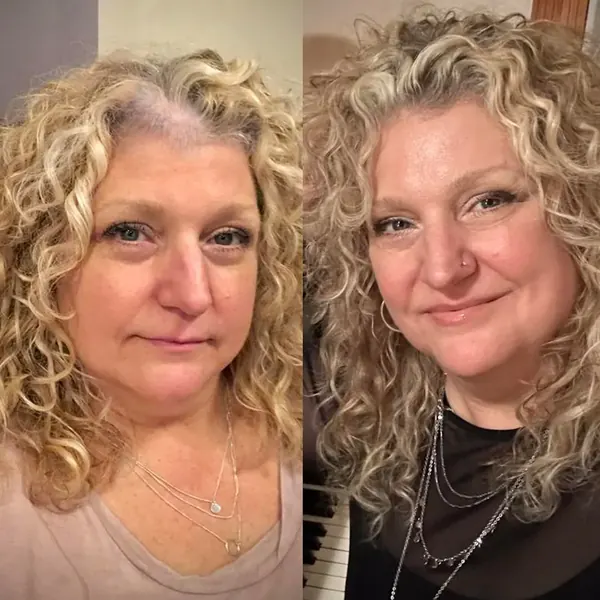 Sarah K. before and after